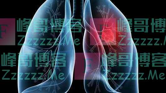 肺癌病人感染疫情，病毒会杀死癌细胞，出现转归吗？