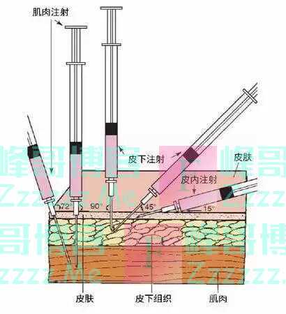 打针时，针芯里的肉去哪里了？我们用一块五花肉做了实验