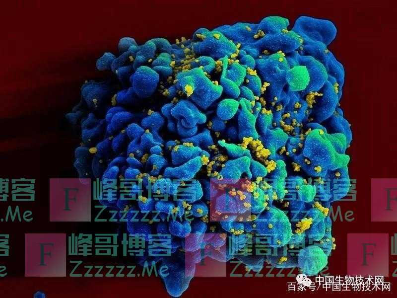 最新研究：艾滋病毒在“男女性行为”传播时会导致更强的毒性