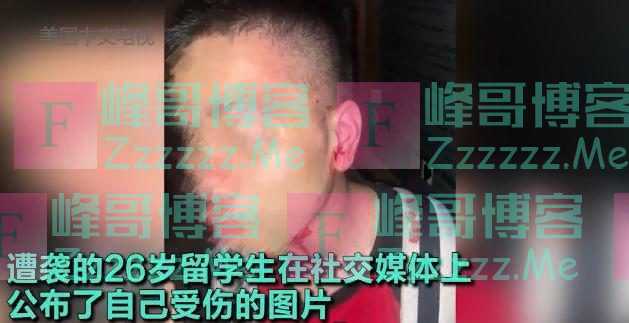 留美中国博士生遭围殴！已有4人被捕，其中一嫌疑人仅15岁……