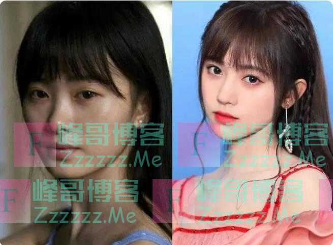 “整容”和“不整容”，有哪些区别？为什么这么多人抢着要整容？
