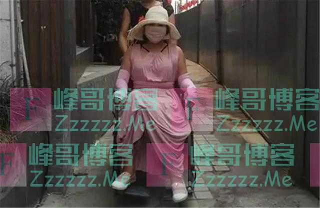 女网红前后整容200多次，花费了上百万，如今后遗症缠身