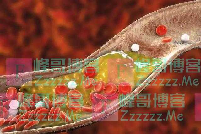 烧开的自来水、桶装水和矿泉水，哪种更健康？一文讲明白