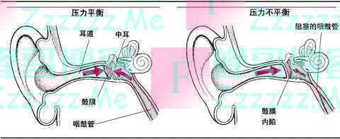 常踮脚尖能防血栓