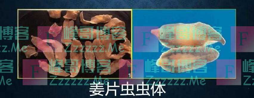 这东西暗藏6000条寄生虫，却被国人当成美食端上桌！很多人吃了还不自知，太恶心了