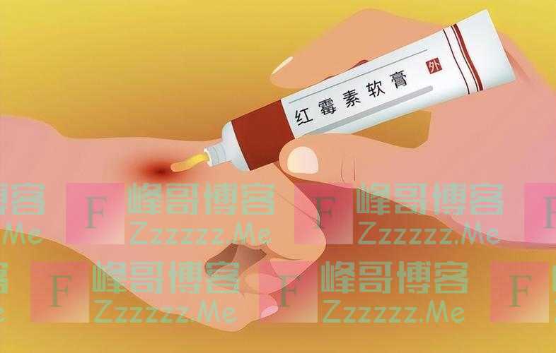 为何有些人满脸“老年斑”，有的却干干净净呢？医生说出实情