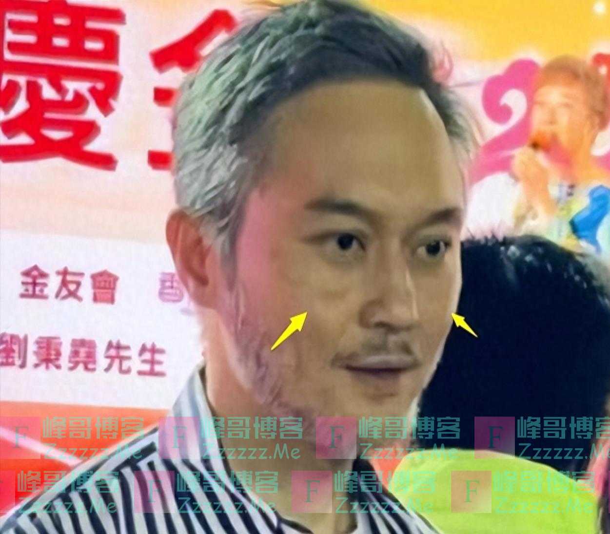 52岁张智霖出警局后首现身,头发花白、老人斑明显,全程无交流