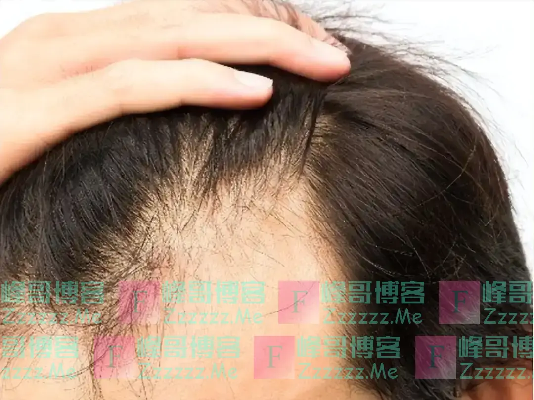 百思不得其解!祸害三年的新冠一夜消失,却留下了3大奇怪现象
