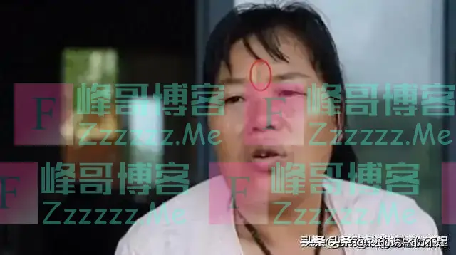 全红婵妈妈额头出现悬针纹,网友直呼:这不正常,要小心!