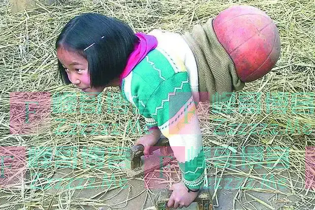 当年那个没腿的“篮球女孩”,如今28岁了,貌美如花,当了公务员